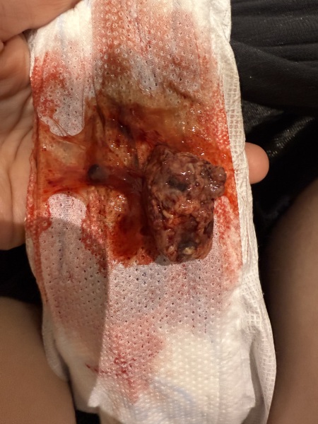 TW* gross picture. Period Help worried