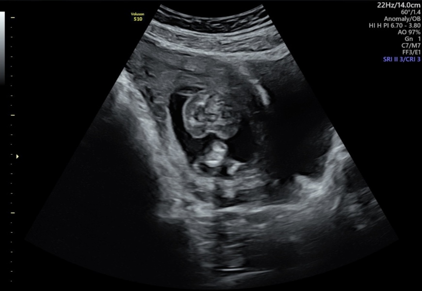 Any Sonographers out there?