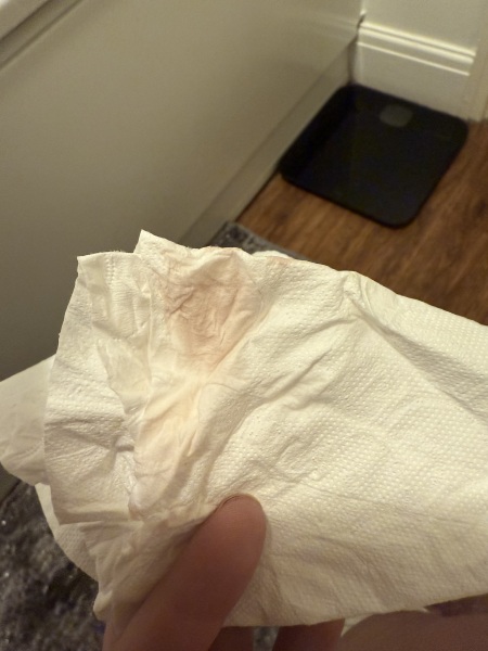 Anyone up for a TMI pic…. Possible implantation