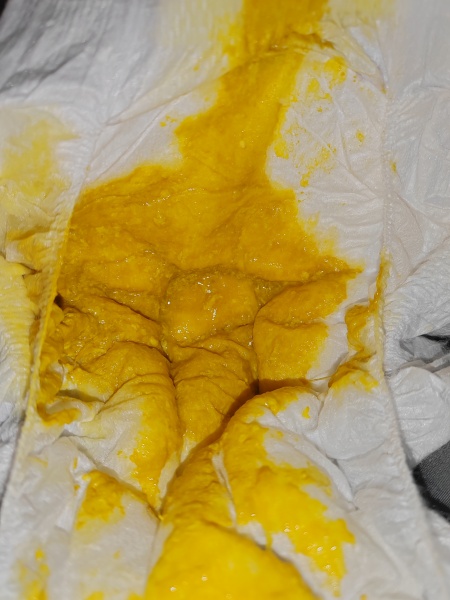 Does this look like normal poo for 5month old