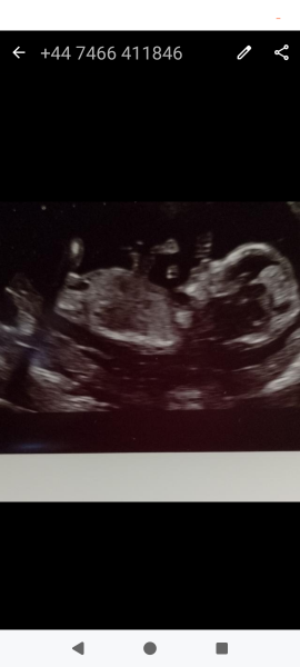 Anyone want me to take a look at their nubs?