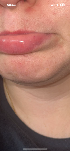 What’s on my lip?