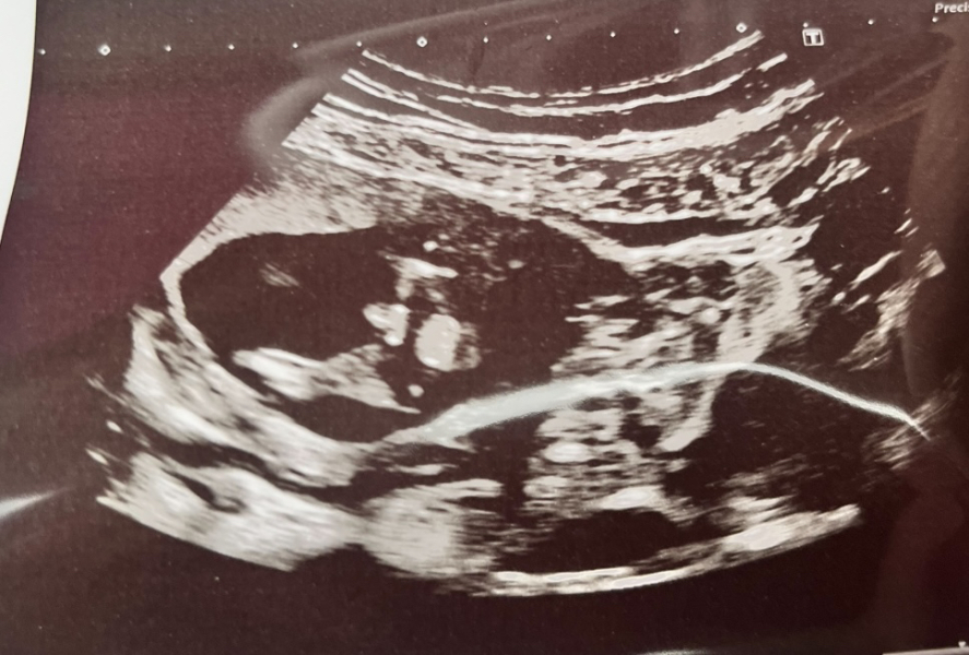 Gender Scan - Potty Shots!