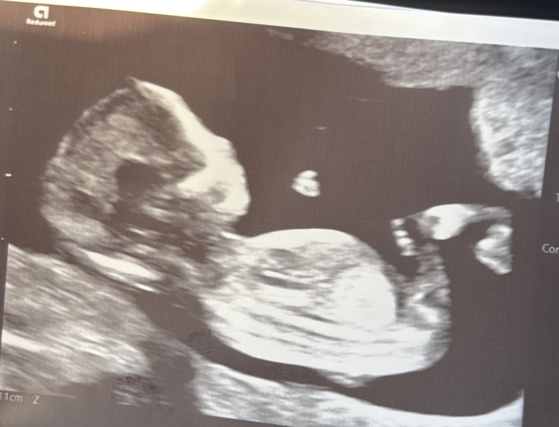 Boy or girl