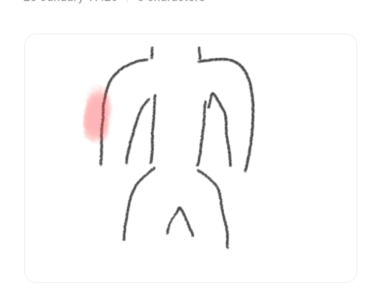 Arm pain