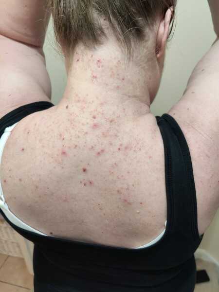 Any ideas what this could be? Drs baffled