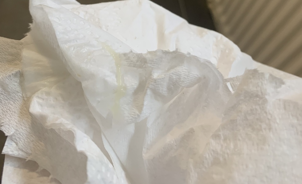 Is this mucus plug? TMI PIC WARNING