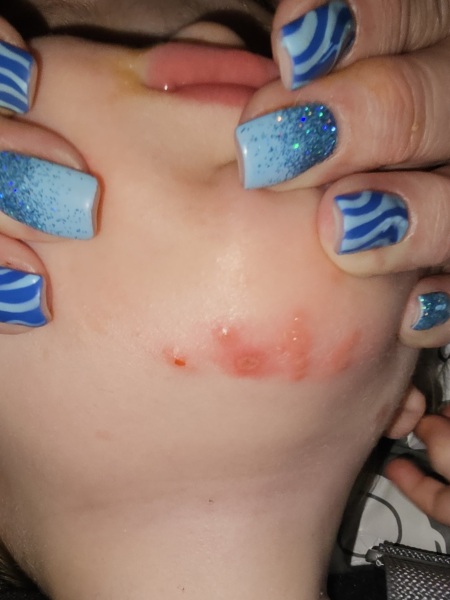 Has anyone had or seen anything like this?