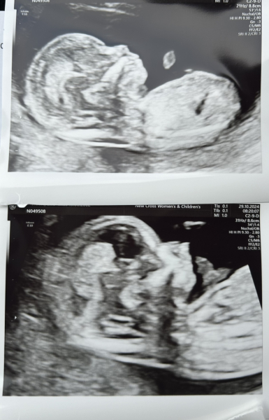 Potty shot! Boy or girl ?!