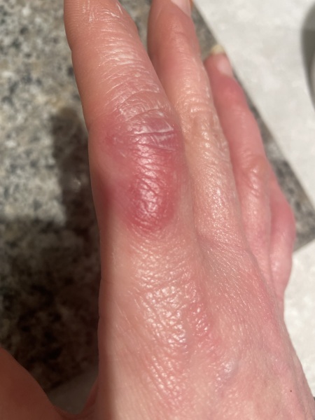 My sausage fingers need help!