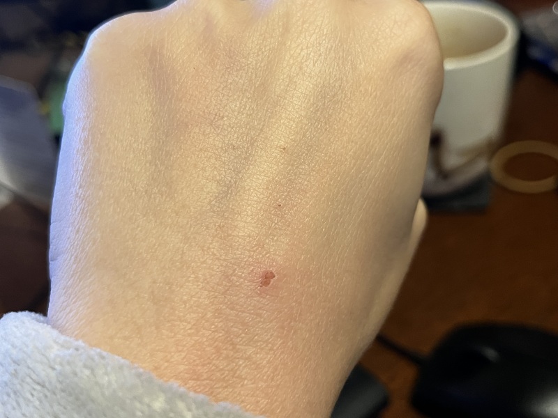 To ask if you think I should go the drs about this?