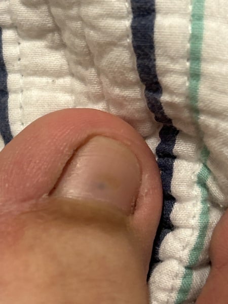 Any idea what this little black spot under my toenail is?