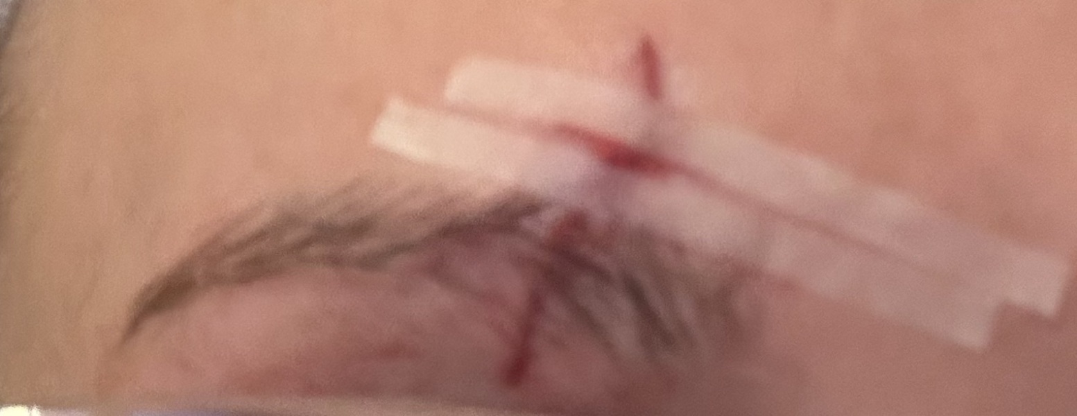 Does this look ok? TW blood / cut
