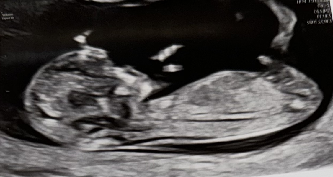 Boy or girl predictions?