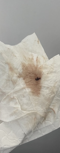 Not sure whats happening TW blood