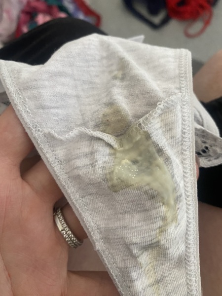 Mucus plug