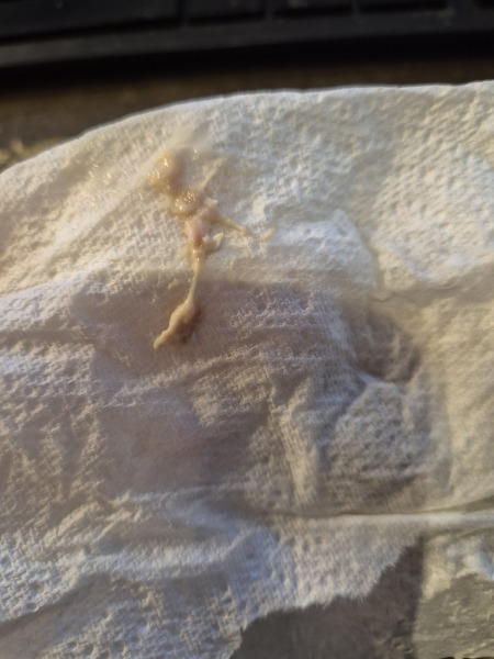 Pink mucus discharge 16 weeks