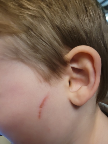 DS being hurt at nursery