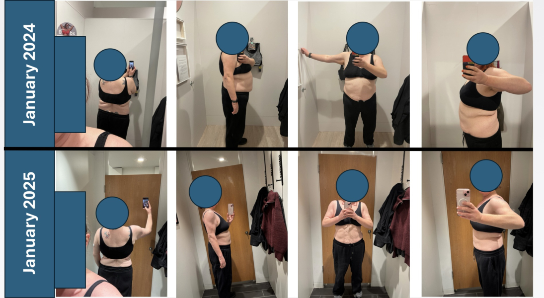 What made you decide to ignore the potential health issues down the line and start injections?