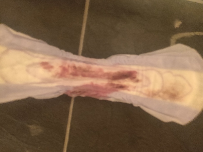 Implantation bleeding or early light period?!