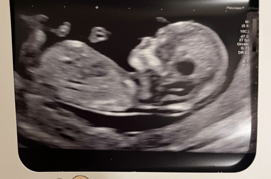 Gender guess