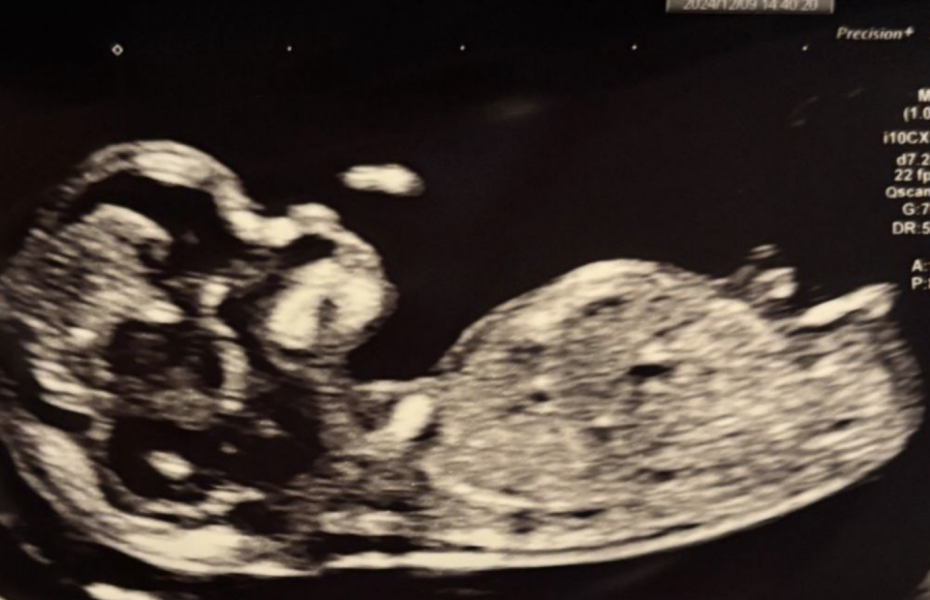 Gender Scan - Potty Shots!