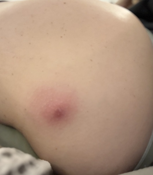 Help me. Can I pop this?!