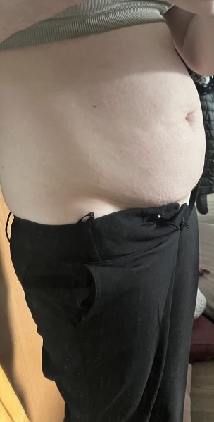 Advice on tummy tuck or liposuction