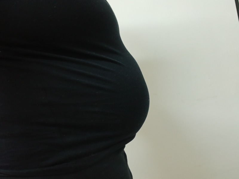 Fibroid belly.
