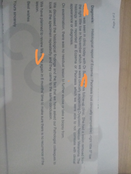 Melanoma on little toe? Picture attached.