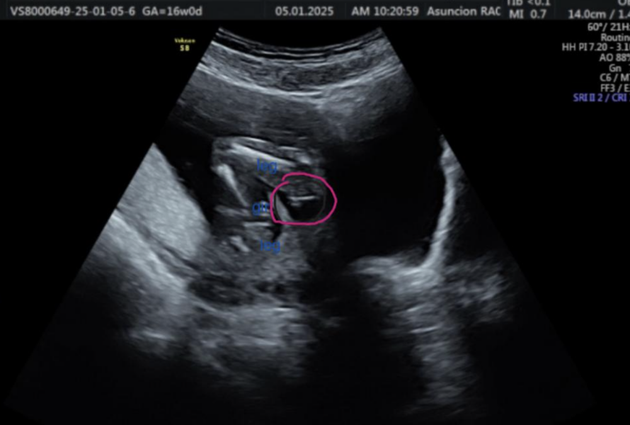 Gender Scan - Potty Shots!