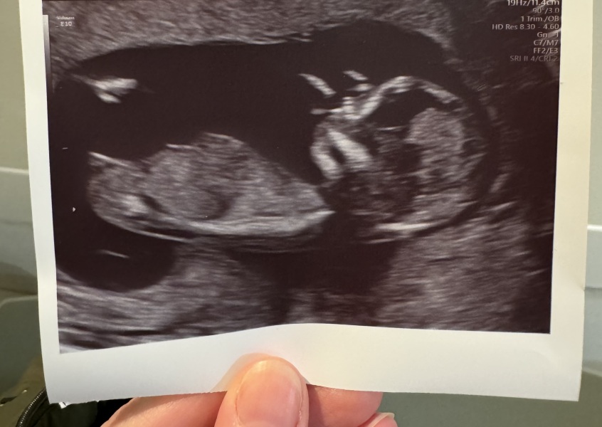 11DPO positive - but concerned