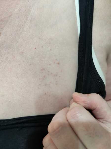 Any ideas what this could be? Drs baffled