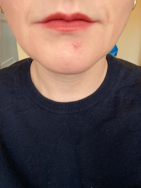 Dark lipstick, thin lips, pale skin