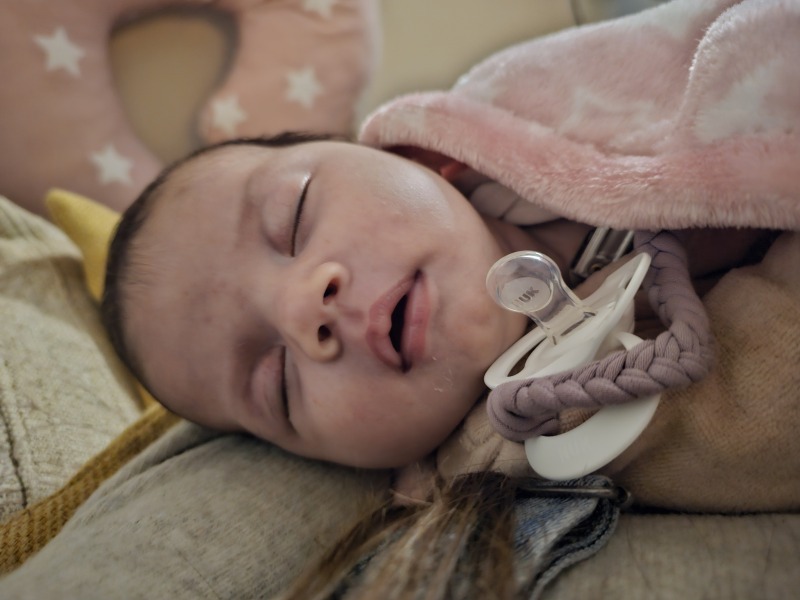 Worried for chromosome syndromes