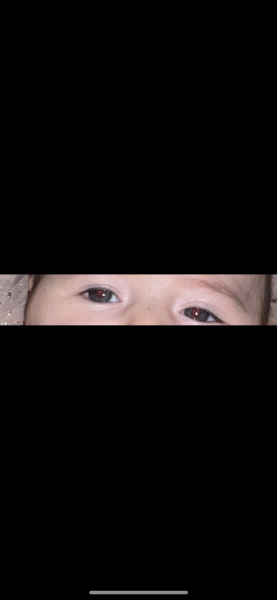 What colour is my newborn eye ?