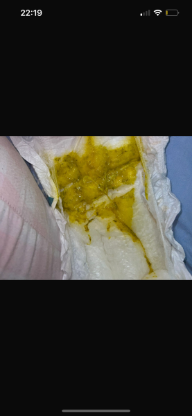 Help what’s wrong with my newborn **Content warning - not for the faint-hearted**