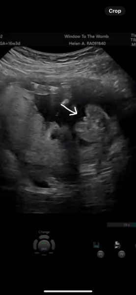 Potty shot! Boy or girl ?!