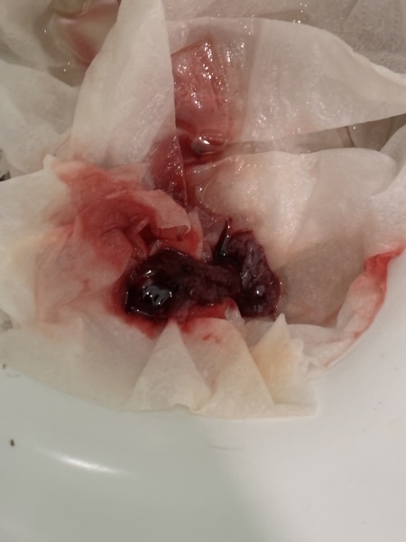 TW PICTURE ATTACHED!! miscarriage?