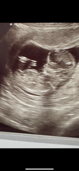 Help on gender
