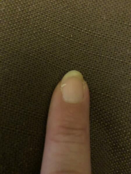 How can I stop this happening?  Breaking nail.