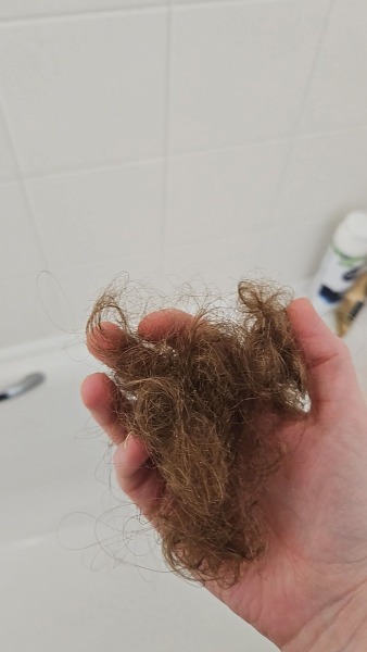 Hair loss help