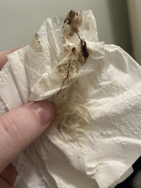 Implantation bleeding?