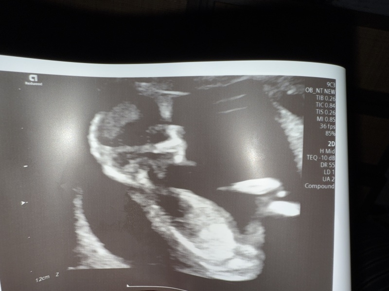 Boy or girl