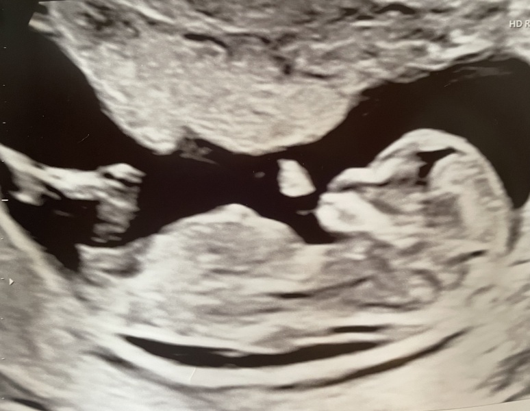 Anyone like to guess the sex?
