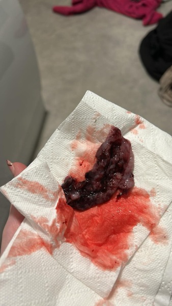 Possible miscarriage