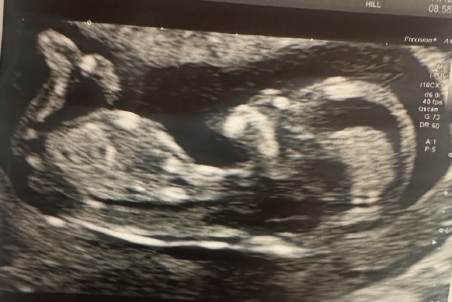 Boy or girl?