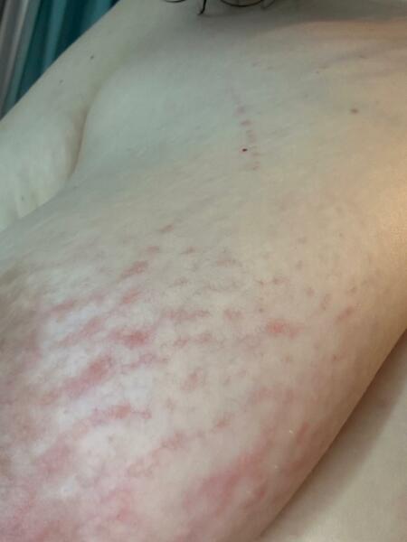 What is this rash?!