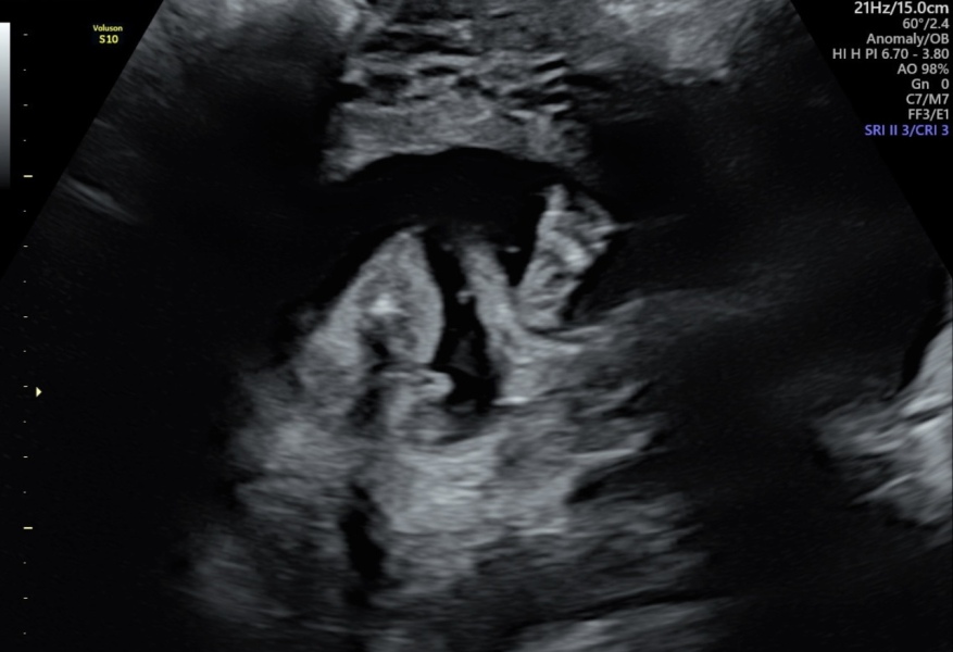 Any Sonographers out there?