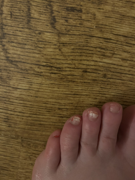 Any podiatrists on here?